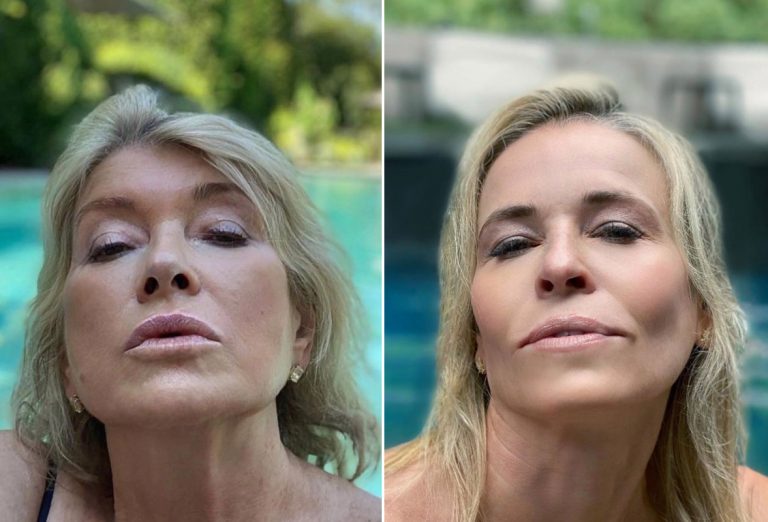 Dagen McDowell facelift botox nose job