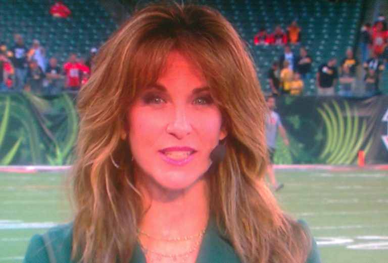 Suzy Kolber facelift nose job body measurements