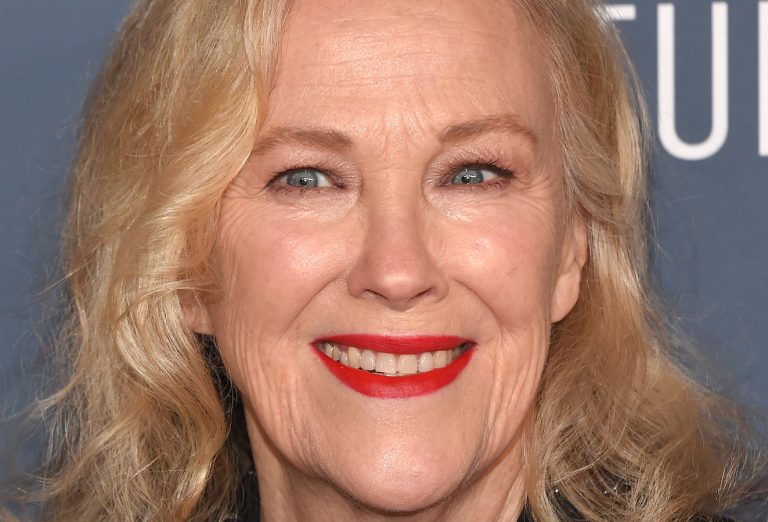 Catherine O'Hara Cosmetic Surgery