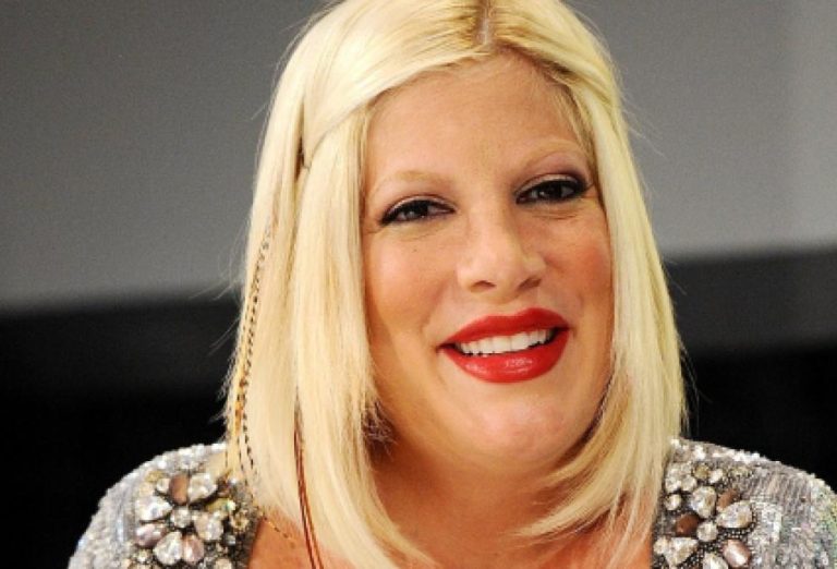 Tori Spelling Cosmetic Surgery